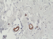 IHC staining of FFPE human breast tissue with recombinant VEGFA antibody at 1:200.