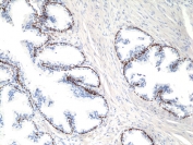 IHC staining of FFPE human prostate tissue with recombinant deltaNp63 antibody at 1:200.