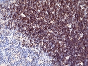 IHC staining of FFPE human thymus tissue with recombinant CD1a antibody at 1:100.