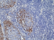 IHC staining of FFPE human tonsil tissue with recombinant Topoisomerase II alpha antibody at 1:100.