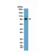Western blot testing of human HeLa cell lysate with recombinant Caldesmon antibody at 1:100 dilution. Predicted molecular weight ~93 kDa, can be observed at 70-80 kDa (non muscle tissue) and 120-150 kDa (smooth muscle).