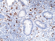 IHC staining of FFPE human appendix tissue with recombinant CD8a antibody at 1:100.