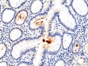 IHC staining of FFPE human stomach tissue with recombinant Helicobacter pylori antibody at 1:100.
