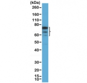 Western blot testing of human HEK293 cell lysate with recombinant FOXP1 antibody at 1:1000 dilution. Expected molecular weight: 65-77 kDa (multiple isoforms).