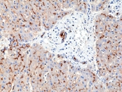 IHC staining of FFPE human liver tissue with recombinant CD13 antibody at 1:200.