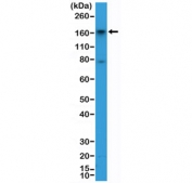Western blot testing of human HepG2 cell lysate with recombinant CD13 antibody at 1:2000 dilution. Expected molecular weight: 110-150 kDa depending on glycosylation level.