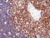 IHC staining of FFPE human thymus tissue with recombinant CD28 antibody at 1:200.