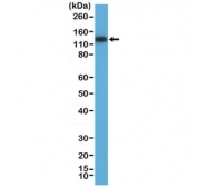 Western blot testing of human HEK293 cell lysate with recombinant MSH3 antibody at 1:800 dilution. Predicted molecular weight ~127 kDa.