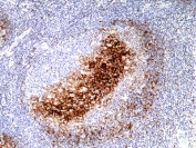 IHC staining of FFPE human tonsil tissue with recombinant CD23 antibody at 1:200.