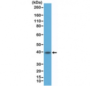 Western blot testing of human Raji cell lysate with recombinant CD23 antibody at 1:500 dilution. Expected molecular weight: 37~45 kDa.