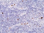 IHC staining of FFPE human tonsil tissue with recombinant Myeloperoxidase antibody at 1:100.