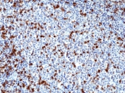 IHC staining of FFPE human tonsil tissue with recombinant ZAP70 antibody at 1:200.