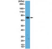 Western blot testing of human Jurkat cell lysate with recombinant ZAP70 antibody at 1:500 dilution. Predicted molecular weight ~70 kDa.
