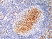 IHC staining of FFPE human tonsil tissue with recombinant CD14 antibody at 1:250.
