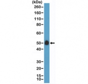 Western blot testing of human placenta lysate with recombinant CD14 antibody at 1:100 dilution. Predicted molecular weight: 40-55 kDa depending on glycosylation level.