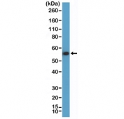 Western blot testing of human HeLa cell lysate using recombinant Keratin 7 antibody at 1:10,000 dilution. Predicted molecular weight ~51 kDa.