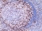 IHC staining of FFPE human tonsil tissue with recombinant ICOS antibody at 1:100.