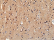 IHC staining of FFPE human brain tissue with recombinant Pan TRK antibody at 1:100.