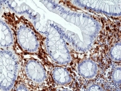 IHC staining of FFPE human colon tissue with recombinant ANXA1 antibody at 1:100.