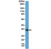 Western blot testing of human K562 cell lysate with recombinant ANXA1 antibody at 1:2000 dilution. Predicted molecular weight ~36 kDa.