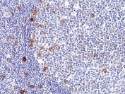 IHC staining of FFPE human tonsil tissue with recombinant CD30 antibody at 1:100.