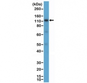 Western blot testing of human K562 cell lysate with recombinant CD30 antibody at 1:1000 dilution. Expected molecular weight: 53-120 kDa depending on glycosylation level.