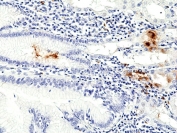 IHC staining of FFPE human stomach tissue with recombinant Helicobacter pylori antibody at 1:100.