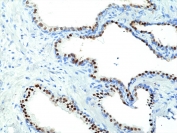 IHC staining of FFPE human prostate tissue with recombinant NKX3.1 antibody at 1:200.