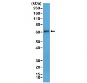 Western blot testing of human MDA-MB-231 cell lysate with recombinant CD73 antibody at 1:1000. Predicted molecular weight: 60-70 kDa.