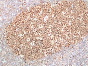 IHC staining of FFPE human tonsil tissue with recombinant Ribonuclease H2 subunit B antibody at 1:100.