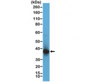 Western blot testing of human Jurkat cell lysate with recombinant Ribonuclease H2 subunit B antibody at 1:1000 dilution. Predicted molecular weight ~35 kDa.