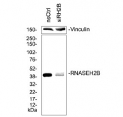 Western blot testing of lysate from human Hela cells treated with RNAseH2B siRNA/RNAiMaxx for 72 hours. Courtesy of Dr. Antje Neeb, The Institute of Cancer Research, London, UK