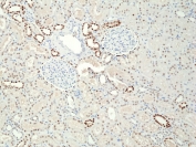 IHC staining of FFPE human kidney tissue with recombinant PAX8 antibody at 1:400.