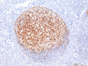 IHC staining of FFPE human tonsil tissue with recombinant Clusterin antibody at 1:100.