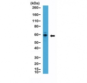 Western blot testing of human MCF7 cell lysate with recombinant P70 S6 Kinase antibody at 1:2000 dilution. Predicted molecular weight: 60-70 kDa.