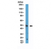 Western blot testing of human Jurkat cell lysate with recombinant HDAC3 antibody. Predicted molecular weight ~49 kDa.