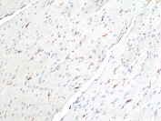IHC staining of FFPE human colon tissue with recombinant DOG1 antibody at 1:100. DOG1-positive cells are interstitial cells of Cajal (ICCs) located within the muscle layer.
