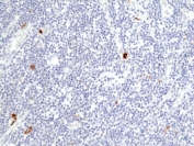 IHC staining of FFPE human tonsil tissue with recombinant Granzyme B antibody at 1:200.