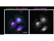 Immunocytochemistry staining of human CHL-1 cells using Detyrosinated Alpha-Tubulin antibody at a 1:200 dilution (pink), anti-alpha-Tubulin antibody (green), and DAPI nuclear stain (blue). Bar: 20um. Image courtesy of Dr. Takashi Hotta from Ohi Lab, University of Michigan, USA.