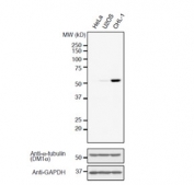 Western blot analysis of human HeLa, U2OS, and CHL-1 cell lysates using Detyrosinated Alpha-Tubulin antibody at a 1:1000 dilution. Image courtesy of Dr. Takashi Hotta from Ohi Lab, University of Michigan, USA.