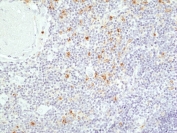 IHC staining of FFPE human thymus tissue with recombinant TIM-3 antibody at 1:200.