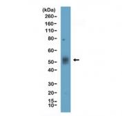 Western blot testing of human Daudi cell lysate with recombinant TIM-3 antibody at 1:1000. Expected molecular weight: 33-70 kDa depending on glycosylation level.
