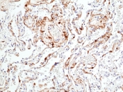 IHC staining of FFPE human lung tissue with recombinant phospho-ERK1/2 antibody at 1:200.