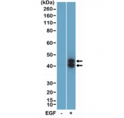 Western blot testing of lysate from human A431 cells, non-treated (-) or treated (+) with EGF, using recombinant phospho-ERK1/2 antibody at a 1:1000 dilution. Expected molecular weight: ERK1 ~42 kDa, ERK2 ~43 kDa.