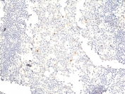 IHC staining of FFPE human tonsil tissue with recombinant phospho-Aurora A/B/C antibody at 1:50.
