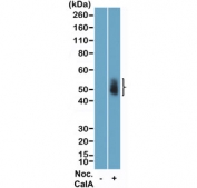 Western blot testing of lysate of human HeLa cells, non-treated (-) or treated (+) with Nocodazole and Calyculin A, using recombinant phospho-Aurora A/B/C antibody at a 1:2500 dilution.
