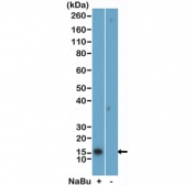 Western blot testing of acid extracts of HeLa cells, treated (+) or untreated (-) with sodium butyrate, using H2BK5ac antibody at 0.02 ug/ml.