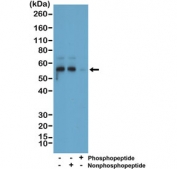 Western blot of mouse brain tissue lysate using recombinant Phosphorylated Tau antibody at a 1:1000 dilution. The phospho-specificity of the antibody was verified by peptide blocking using a phosphopeptide or non-phosphopeptide targeting residue Ser396.