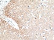IHC staining of FFPE human brain tissue with recombinant Phosphorylated Tau antibody at 1:50.