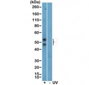 Western blot testing of the lysate of human HeLa cells treated (+) or nontreated (-) with UV, using recombinant phosphorylated JNK antibody at a 1:200 dilution.